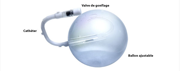 ballon_ajustable_description01
