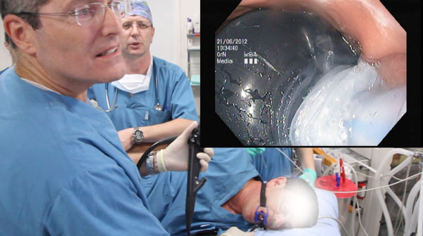ballon_ajustable_implantation